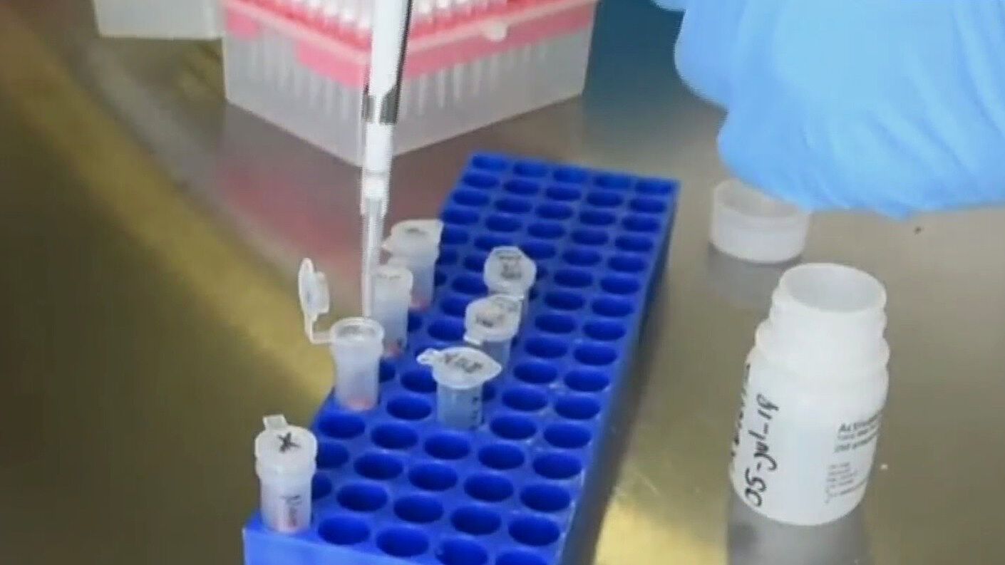 ¿Cuál es la importancia del ácido ribonucleico o ARN? N+