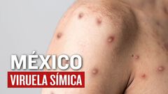 Juan, uno de los mexicanos contagiados con vi...